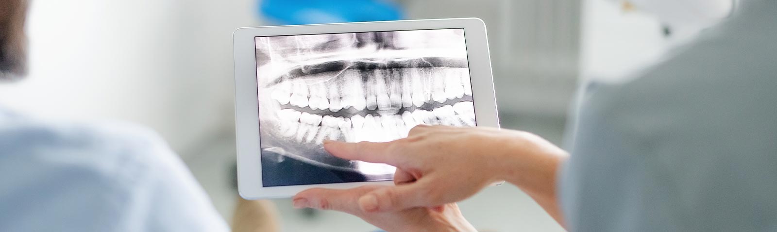 A medical professional holding up an X-ray on a tablet screen, with a focus on dental care.